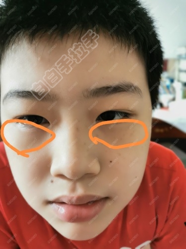 113045qwtzc7wzqn1zlkzb.jpg