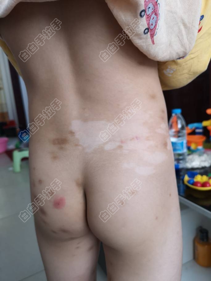 145741xzcprsjmvm1j5jtc.jpg