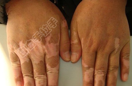 src=http___www.nbglkj.com_uploads_allimg_20121108_99491352366288.jpg&amp;refer=htt.jpg