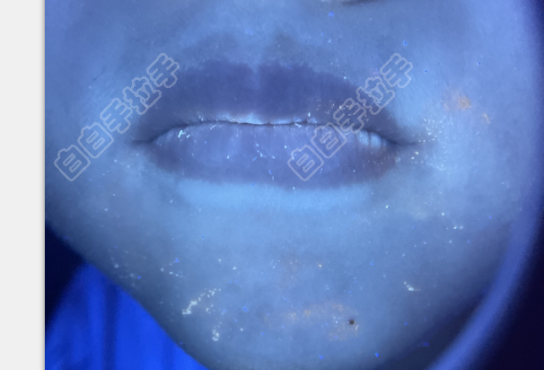 һȦɫ