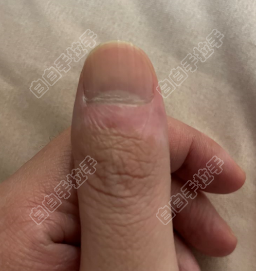 ΢Žͼ_20211212191514.png
