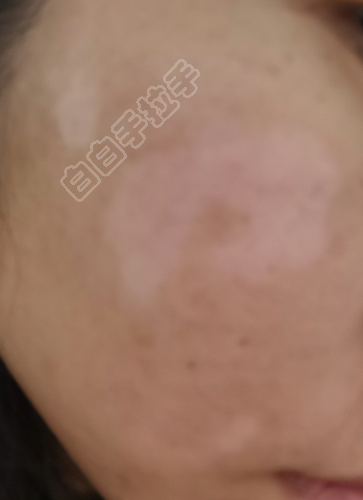 Screenshot_20220426_171958_com.android.gallery3d.png
