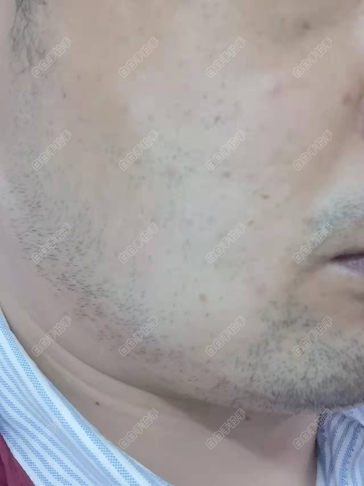 沿