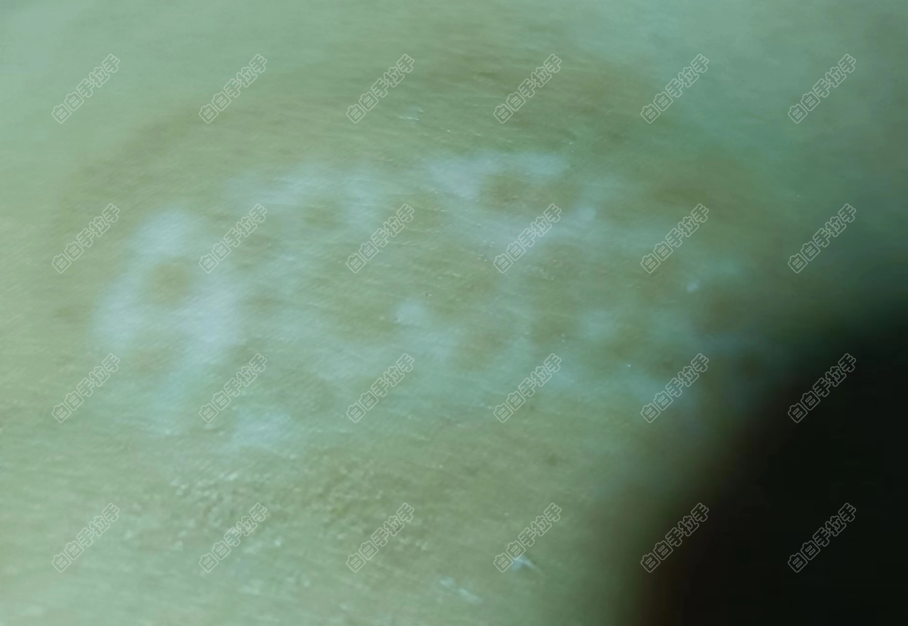 22궬Ͳˣڻָ