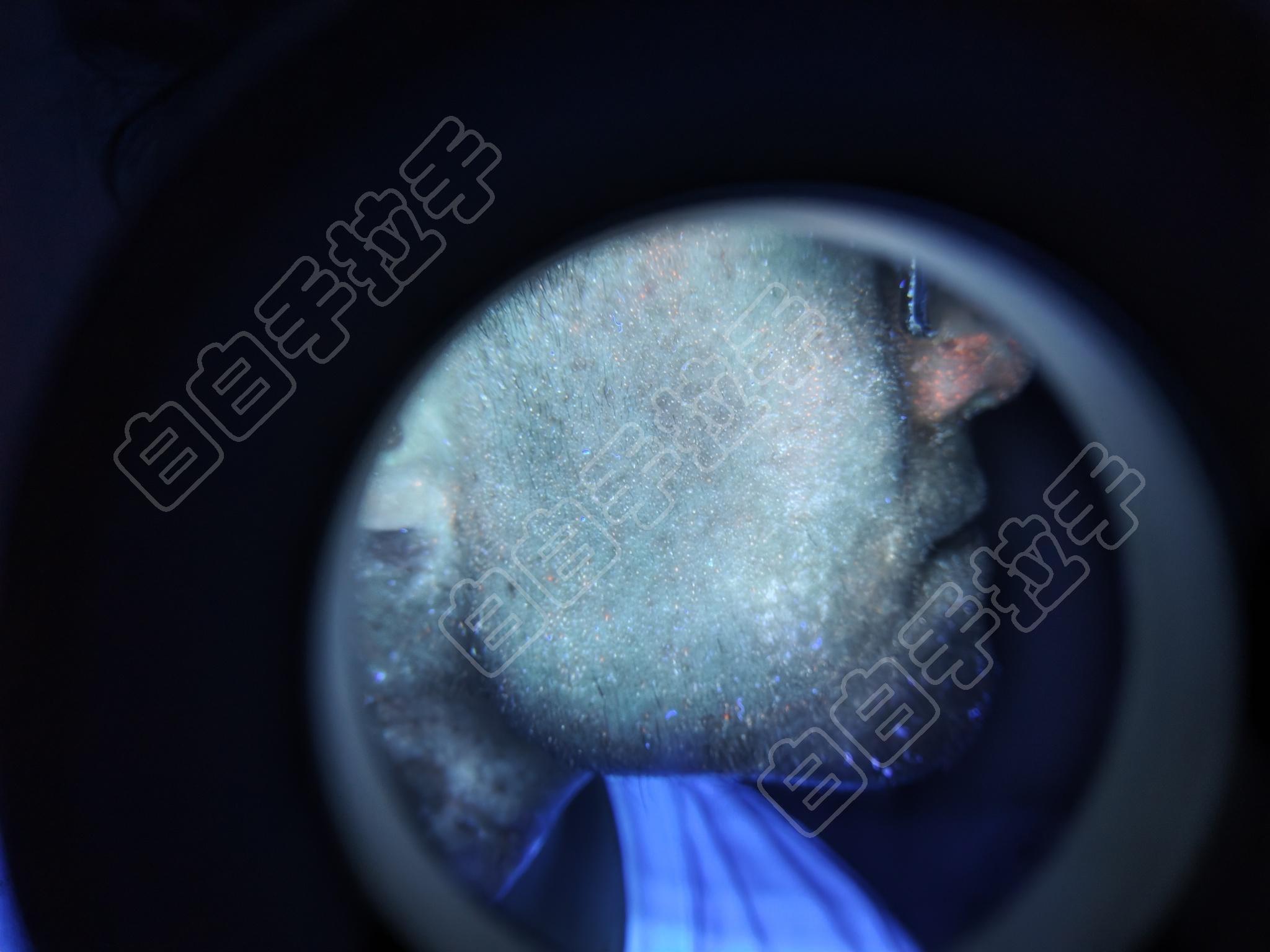 帮忙看看脸上有没有白癜风-白癜风确诊&症状-白白手拉手-手拉手白癜风